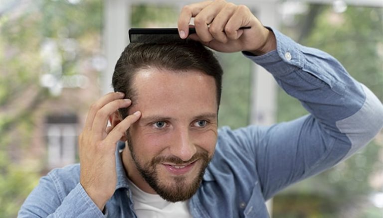 Meilleur âge pour avoir une greffe de cheveux : conseils et considérations